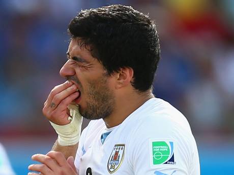 Uruguay striker Luis Suarez bite Italy's Giorgio Chiellini - FIFA World Cup 2014